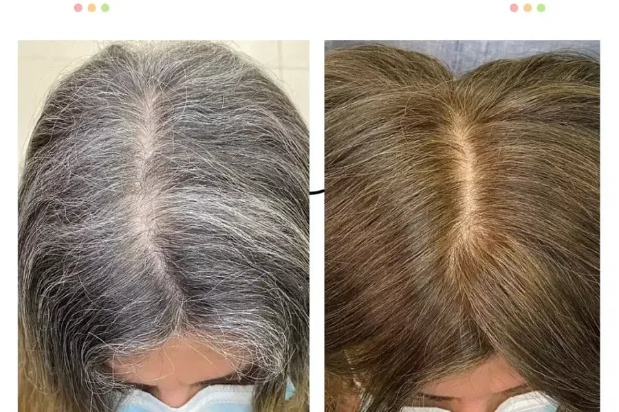 Shampoo Chao Canas